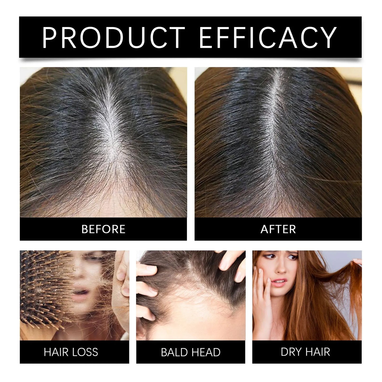 30ml Marjoran Mi Hair Oil Moisture Replenishment Essence bottle for dry hair repair.