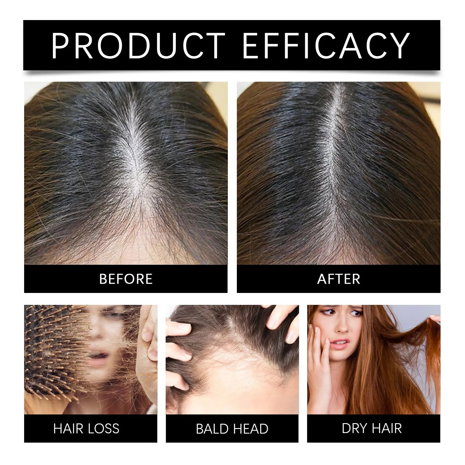 30ml Marjoran Mi Hair Oil Moisture Replenishment Essence bottle for dry hair repair.