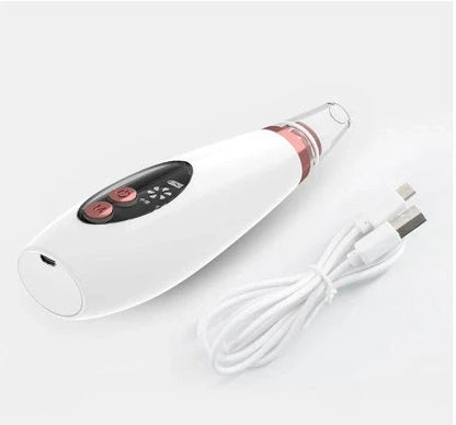 Microcrystalline Blackhead Removal Device with powerful suction for deep pore cleansing and flawless skin