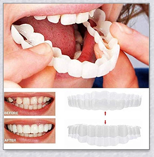 Snap-On Veneers: Disguise dental imperfections and upgrade your smile instantly