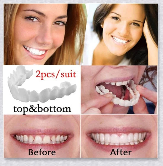 Snap-On Veneers: Disguise dental imperfections and upgrade your smile instantly