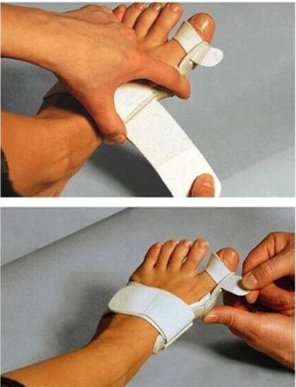 Comfortable Hallux Valgus Brace - Innovative Foot Care Solution for Pain Relief