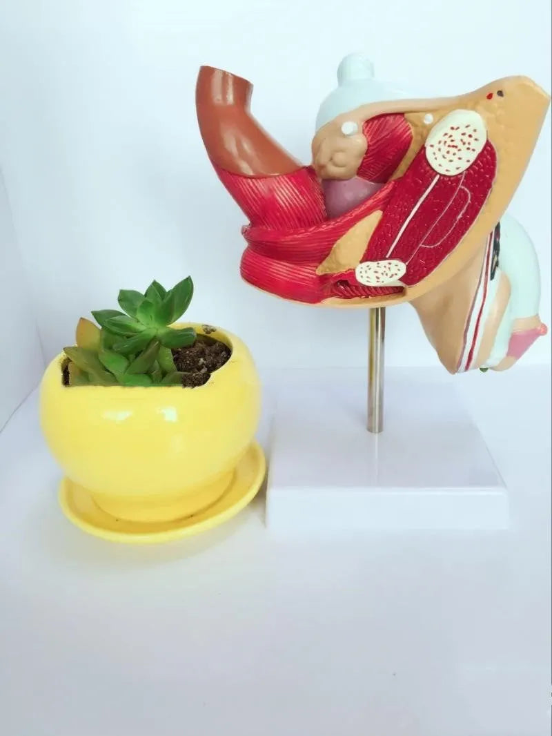 Detailed plastic anatomical model of male reproductive system showing pathologies including prostate enlargement.