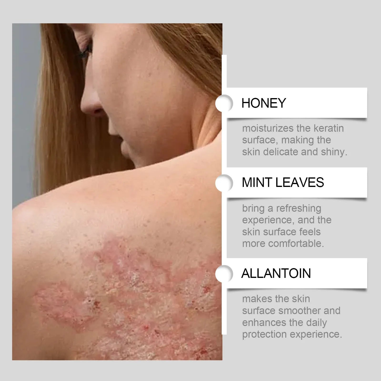 60g eczema repair cream container with honey and mint leaves formulation
