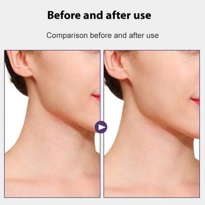 Neck firming adhesive tape patches in skin tone with four packs containing twenty patches total