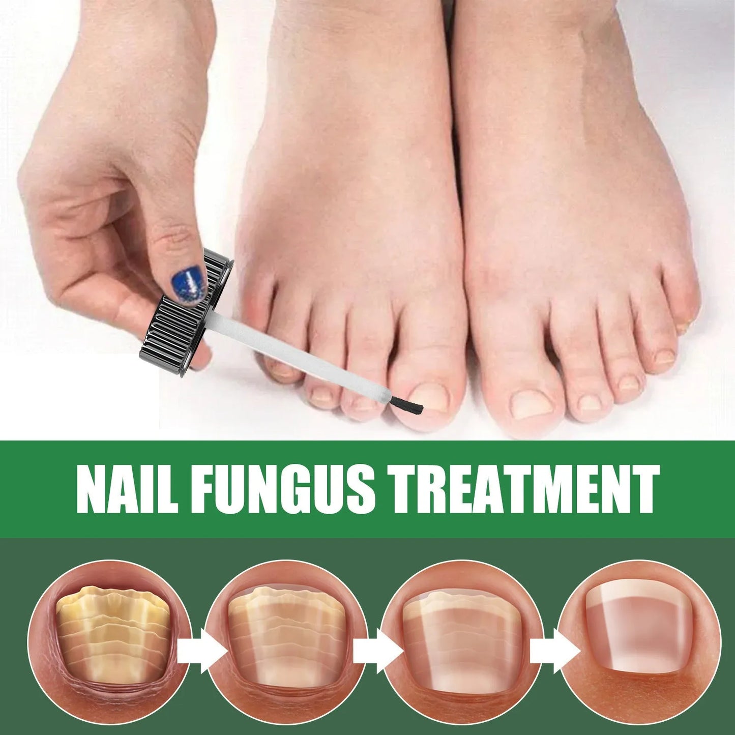30ml bottle of tea tree oil nail repair fluid for hand and foot care.