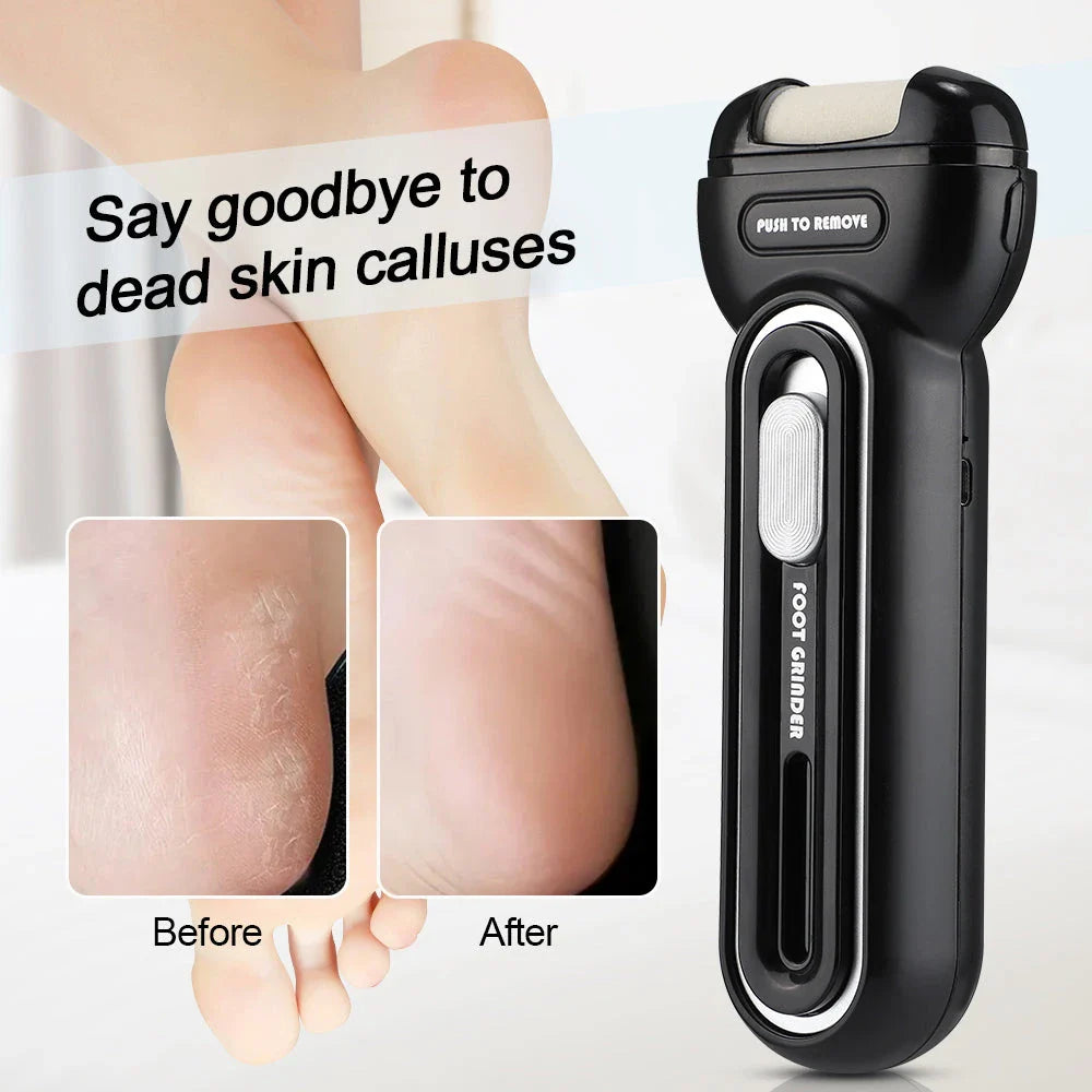Professional Electric Foot Callus Remover with dual-speed motor and interchangeable grinding heads for customised foot care