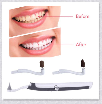 Sonic Tooth Stain Remover - Advanced plaque removal tool for at-home dental care and teeth whitening