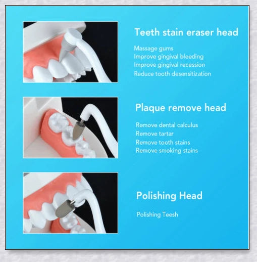 Sonic Tooth Stain Remover - Advanced plaque removal tool for at-home dental care and teeth whitening
