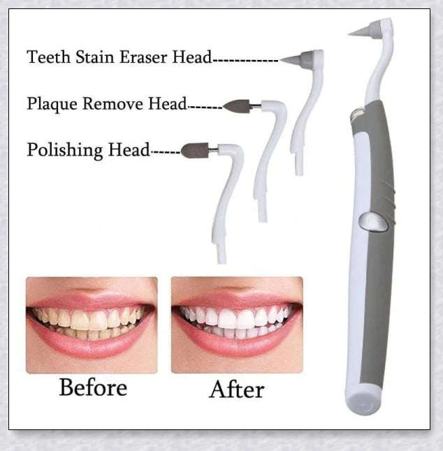 Sonic Tooth Stain Remover - Advanced plaque removal tool for at-home dental care and teeth whitening