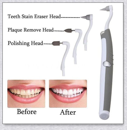 Sonic Tooth Stain Remover - Advanced plaque removal tool for at-home dental care and teeth whitening