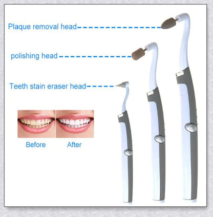 Sonic Tooth Stain Remover - Advanced plaque removal tool for at-home dental care and teeth whitening