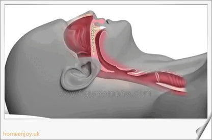 Closeup of the Electric Anti Snore Device with different color options