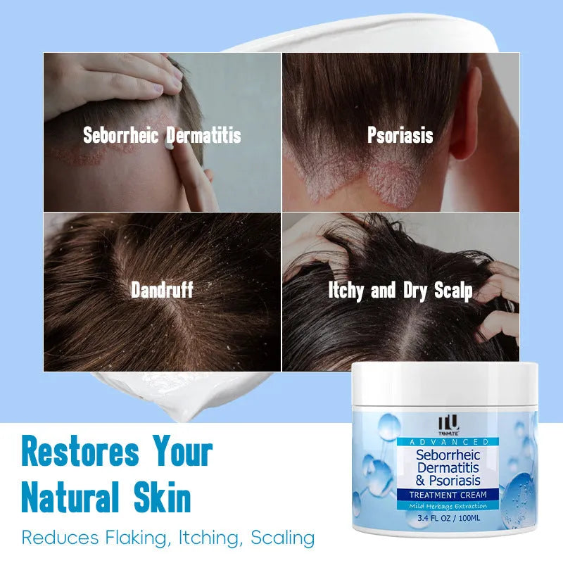 Herbal Extraction Treatment Cream for Seborrheic Dermatitis Psoriasis and Dandruff 100ml 150g Scalp Care Cream with Natural Homeopathic Formula for Itchy Dry Flaky Scalp Relief