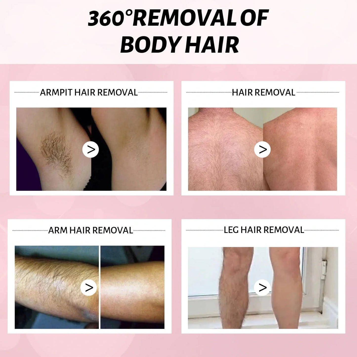 Mu Si Honey Hair Removal Spray for smooth, hair-free skin without irritation