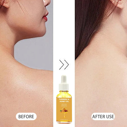 30ml bottle of Turmeric Honey Essential Oil in neutral packaging for facial skincare.