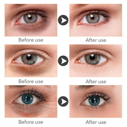 30ml container of Beauty Eye Cream for women's skincare.