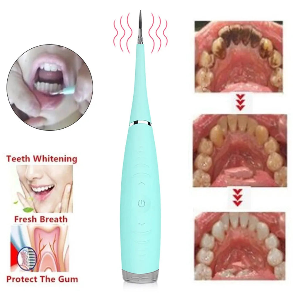 Pink and blue waterproof electric tooth scaler with 190mm handle for dental calculus removal