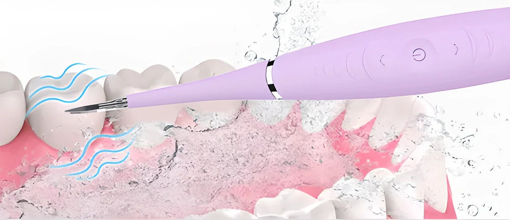 Premium Ultrasonic Sonic Dental Scaler - Powerful vibrations for deep cleaning and teeth whitening