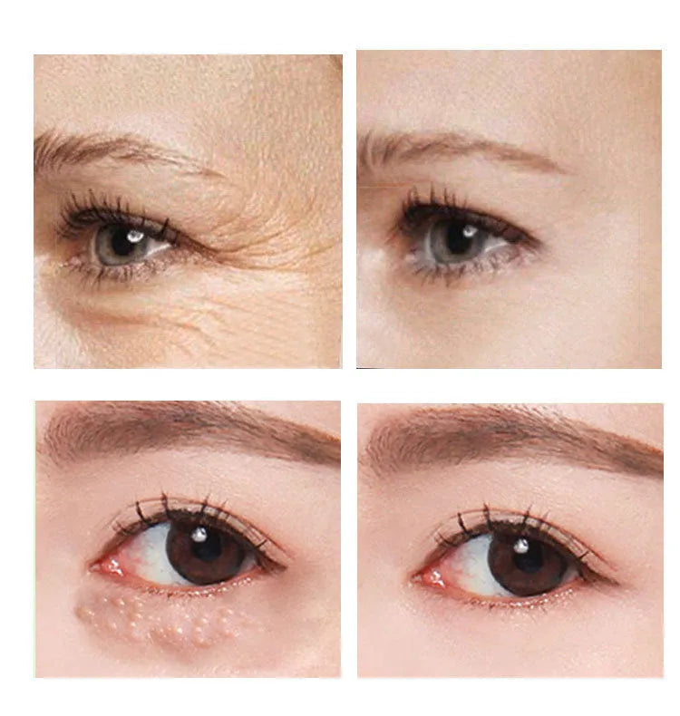 30ml container of Beauty Eye Cream for women's skincare.