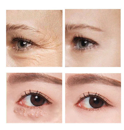 30ml container of Beauty Eye Cream for women's skincare.
