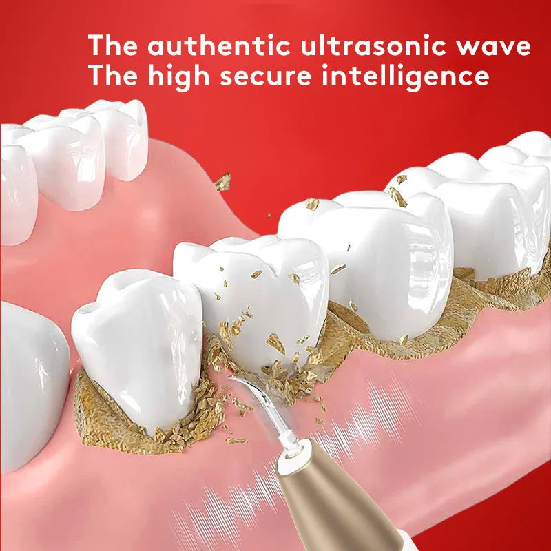 Gold-coloured ultrasonic tooth cleaner and tartar remover device with a stainless steel tip.