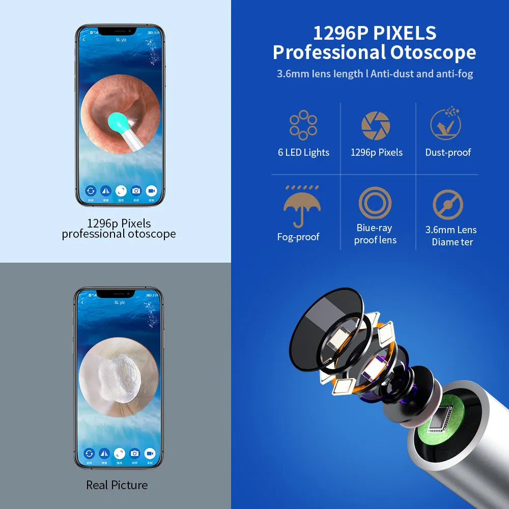 NE3 wireless otoscope ear cleaning kit with camera, LED light, and spoon heads