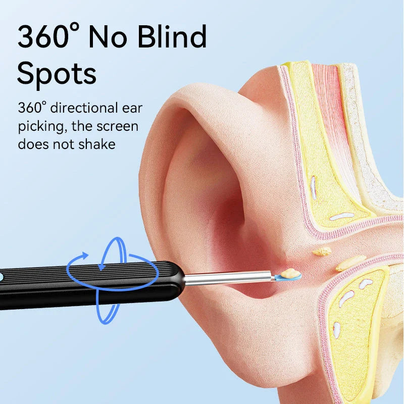 HD Visual Ear Cleaner with Camera - State-of-the-art ear hygiene tool with integrated camera for precise ear wax removal