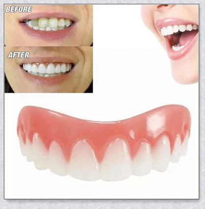 Premium teeth veneers that instantly transform your smile by concealing crooked, stained, or missing teeth