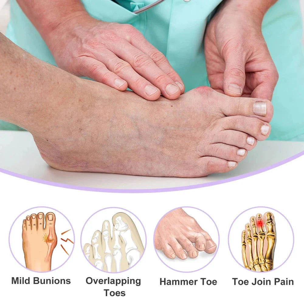 Pair of premium silicone toe separators for foot care and pain relief, made from high-quality SEBS material