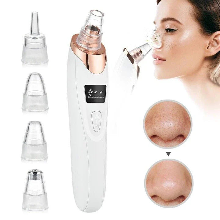 Advanced electric blackhead remover vacuum with customisable suction and interchangeable heads for deep pore cleansing and skin rejuvenation