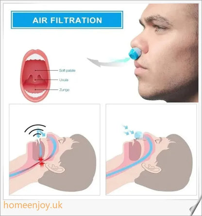 Airing: The First Portable, Discreet and Hassle-Free Micro-CPAP Device for Sleep Apnea Relief