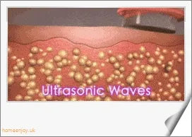 Ultrasonic Cavitation Fat Burner Device with Infrared Therapy and Microcurrent for Body Slimming and Anti-Cellulite Treatment