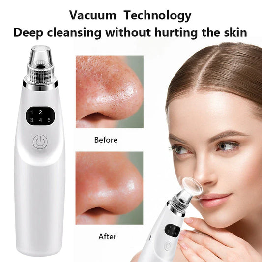 Advanced electric blackhead remover vacuum suction tool for deep pore cleansing and skin rejuvenation