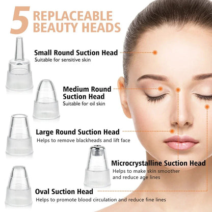 Advanced electric blackhead remover vacuum with customisable suction and interchangeable heads for deep pore cleansing and skin rejuvenation